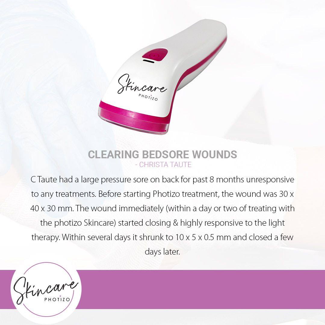 SKINCARE- Photizo Therapy For Treatment Of Wounds/Scars