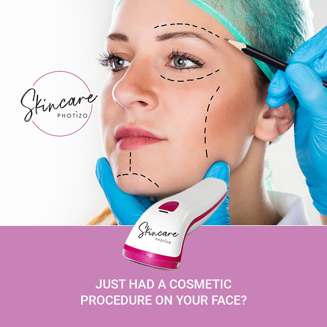 SKINCARE- Photizo Therapy For Treatment Of Wounds/Scars