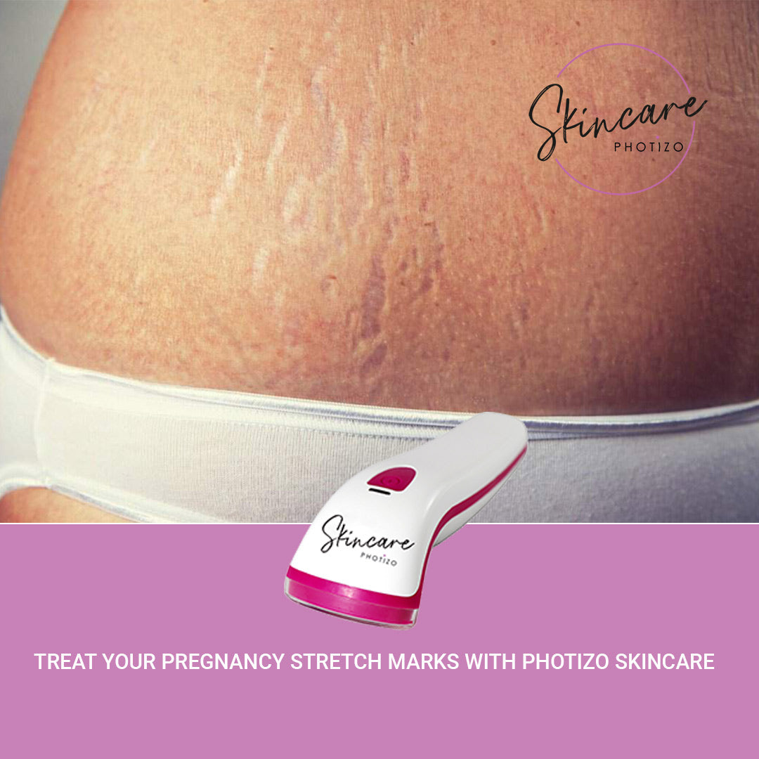 SKINCARE- Photizo Therapy For Treatment Of Wounds/Scars