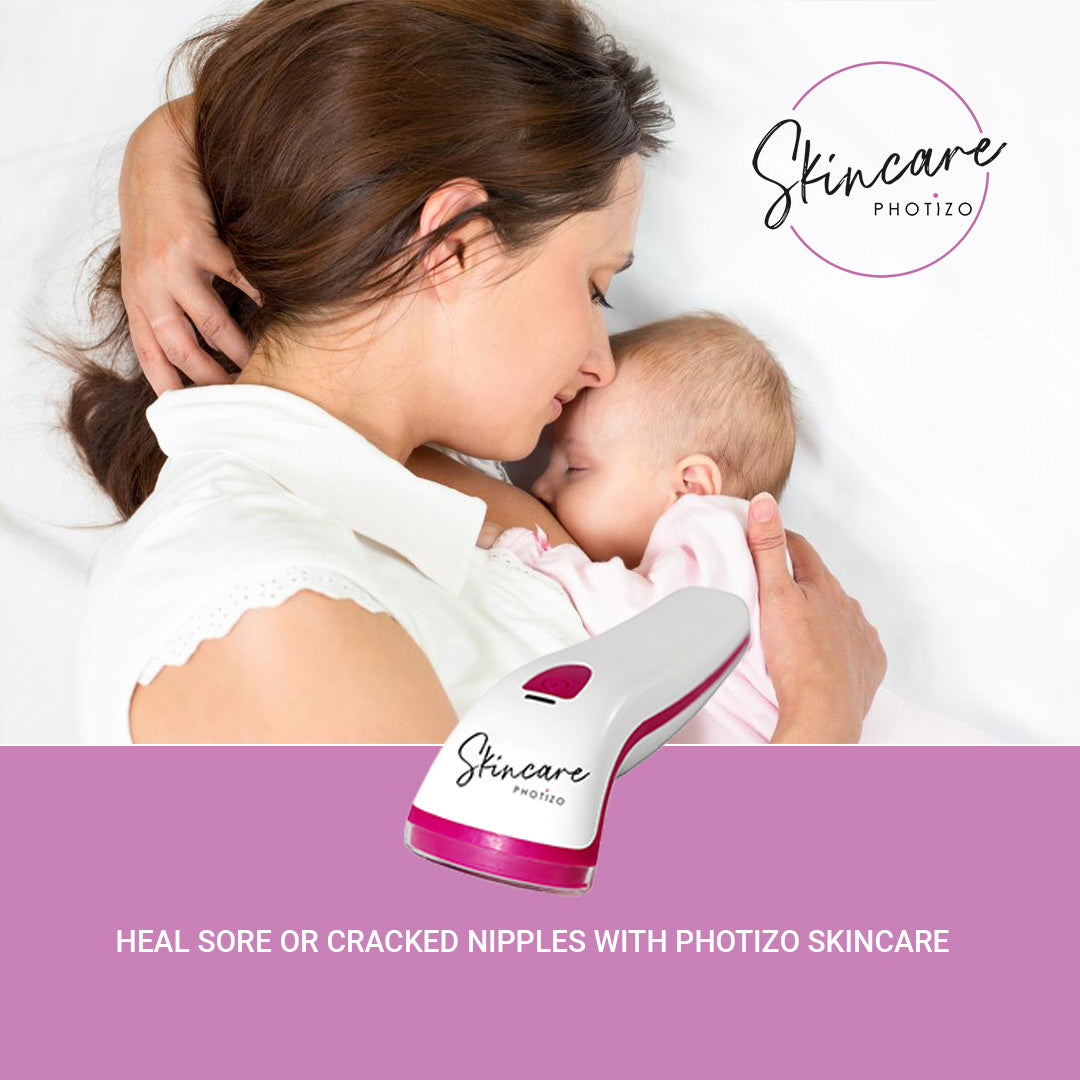 SKINCARE- Photizo Therapy For Treatment Of Wounds/Scars